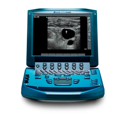 Sonosite Micromaxx Ultrasound