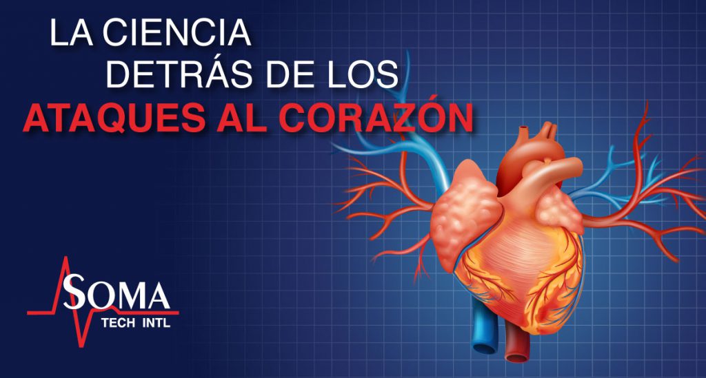 Infarto De Miocardio La Ciencia Detrás De Un Ataque Al Corazón